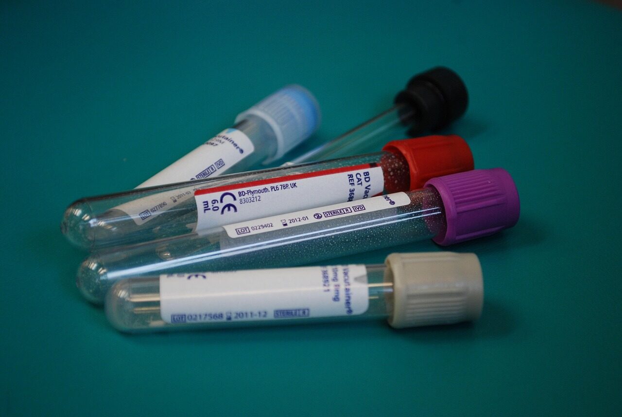 Thyroid Profile Test