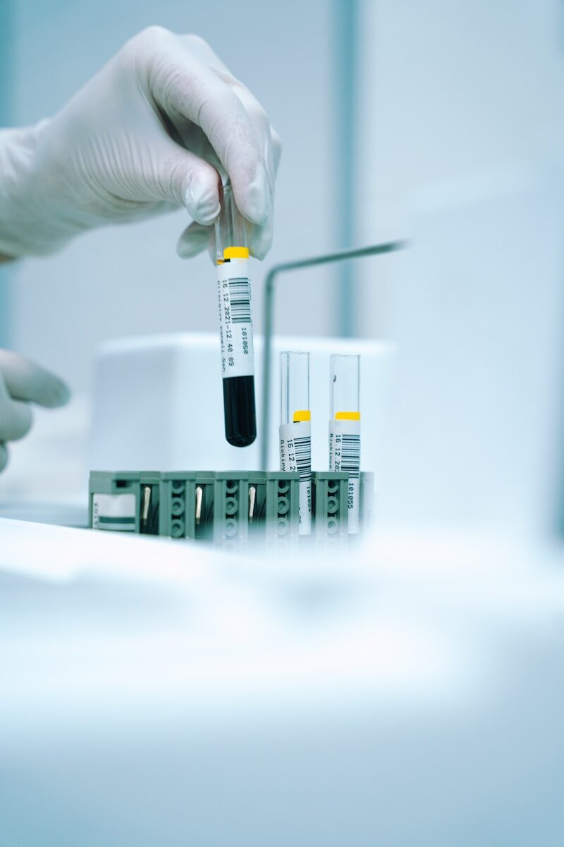 Lipid Profile test