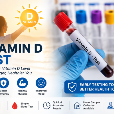 Vitamin D Test
