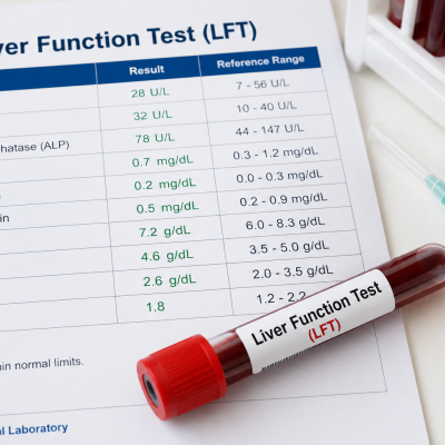 Liver Function Test